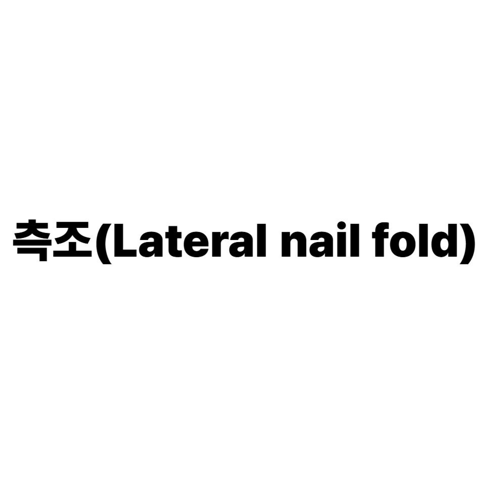 측조