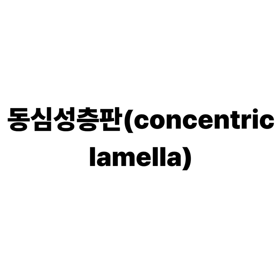 동심성층판